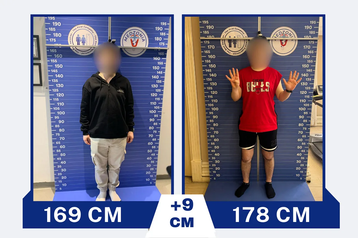 Before After 12