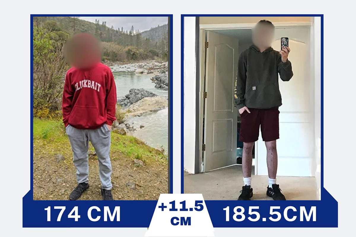 Before After 4