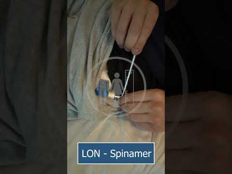 Comparación entre LON y Precice