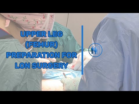 UPPER LEG (FEMUR) / PREPARATION FOR LON SURGERY