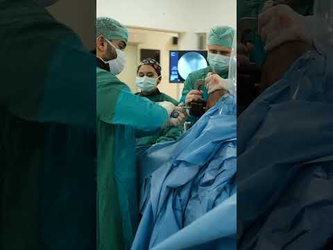 الاطالة بجهاز لون من الساقين
