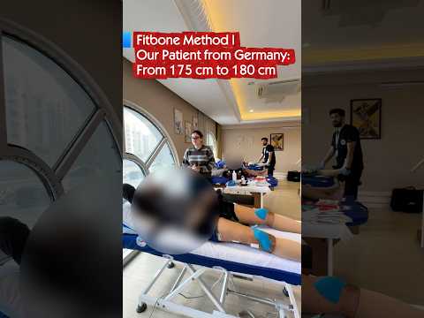 Fitbone Method | Our Patient from Germany’s Journey from 175 cm to 180 cm