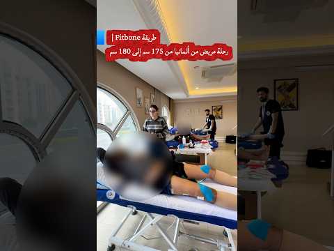 طريقة Fitbone | رحلة مريض من ألمانيا من 175 سم إلى 180 سم