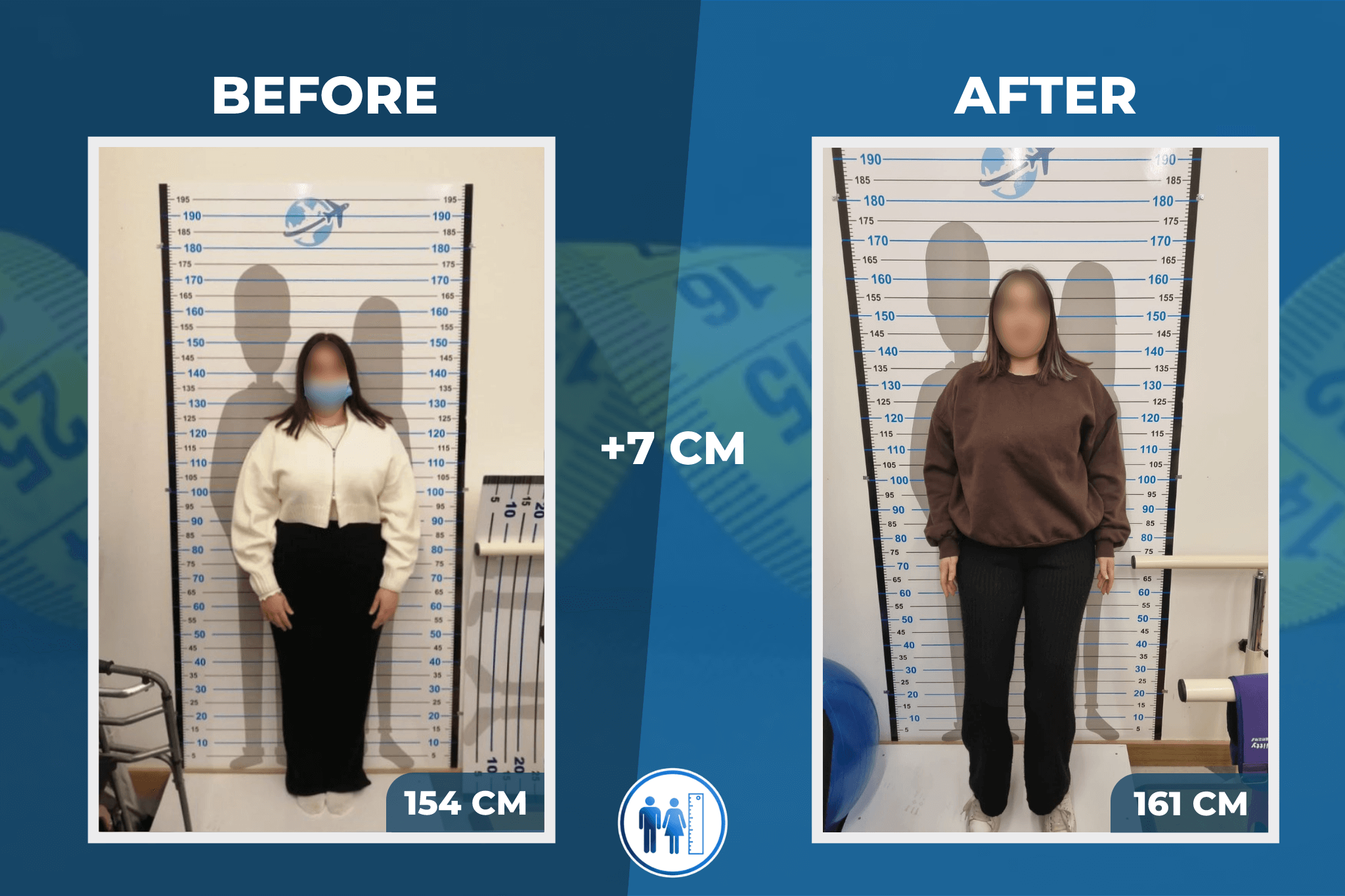 limb-lengthening-surgery-before-after-2