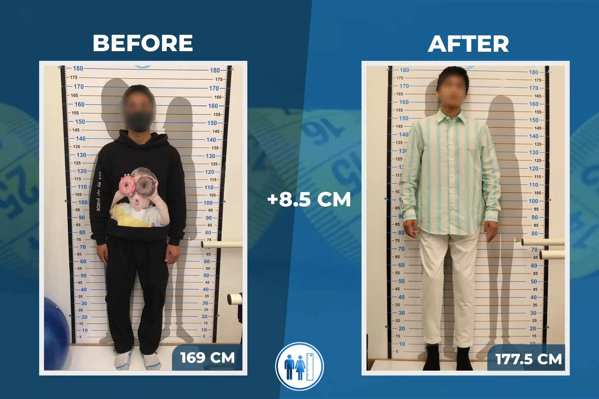 limb-lengthening-surgery-before-after-7